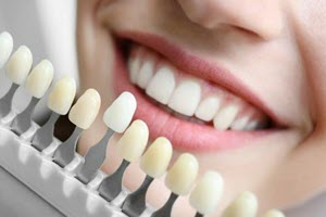 Відновлення Природної Краси: Естетична Реставрація у City Dental